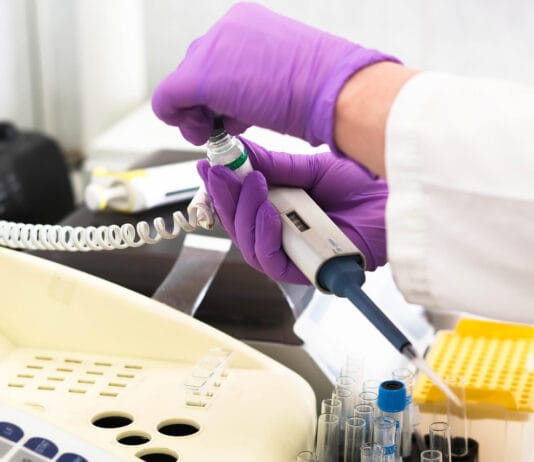 Odpowiedzialna profilaktyka w związku: kiedy wykonać VDRL i jak o tym rozmawiać